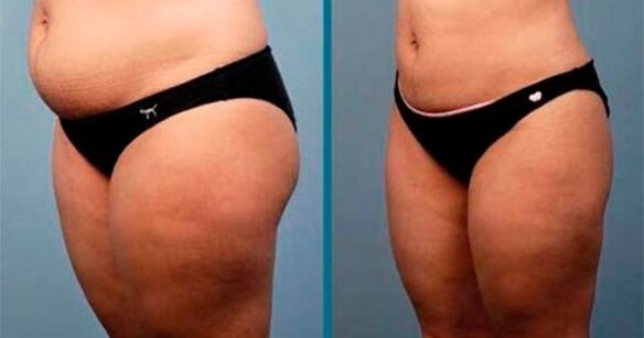 Methods for losing weight by 10 kilograms in a month